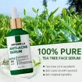 Salicylic Acid Pore Refining Serum – 30ml | Oil Control & Anti-Wrinkle Facial Essence